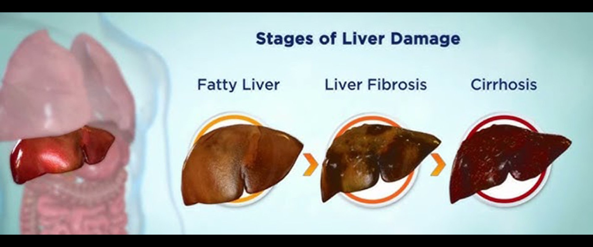 華肝基因 股份有限公司  