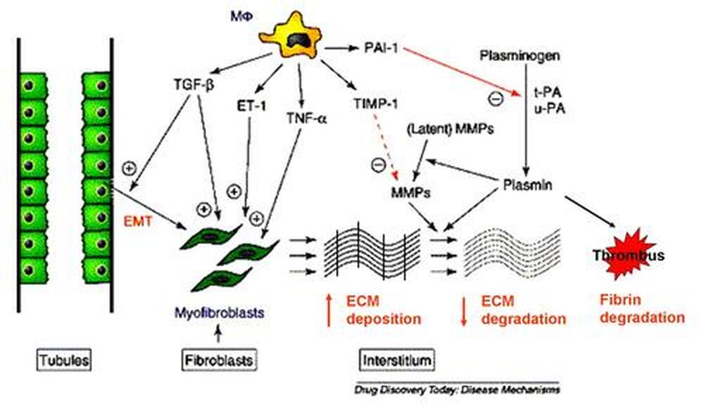 ECM形成與組織硬化