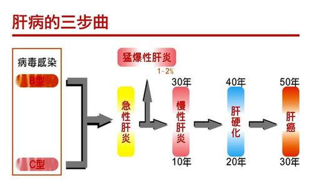 BC肝病毒數是肝癌指標